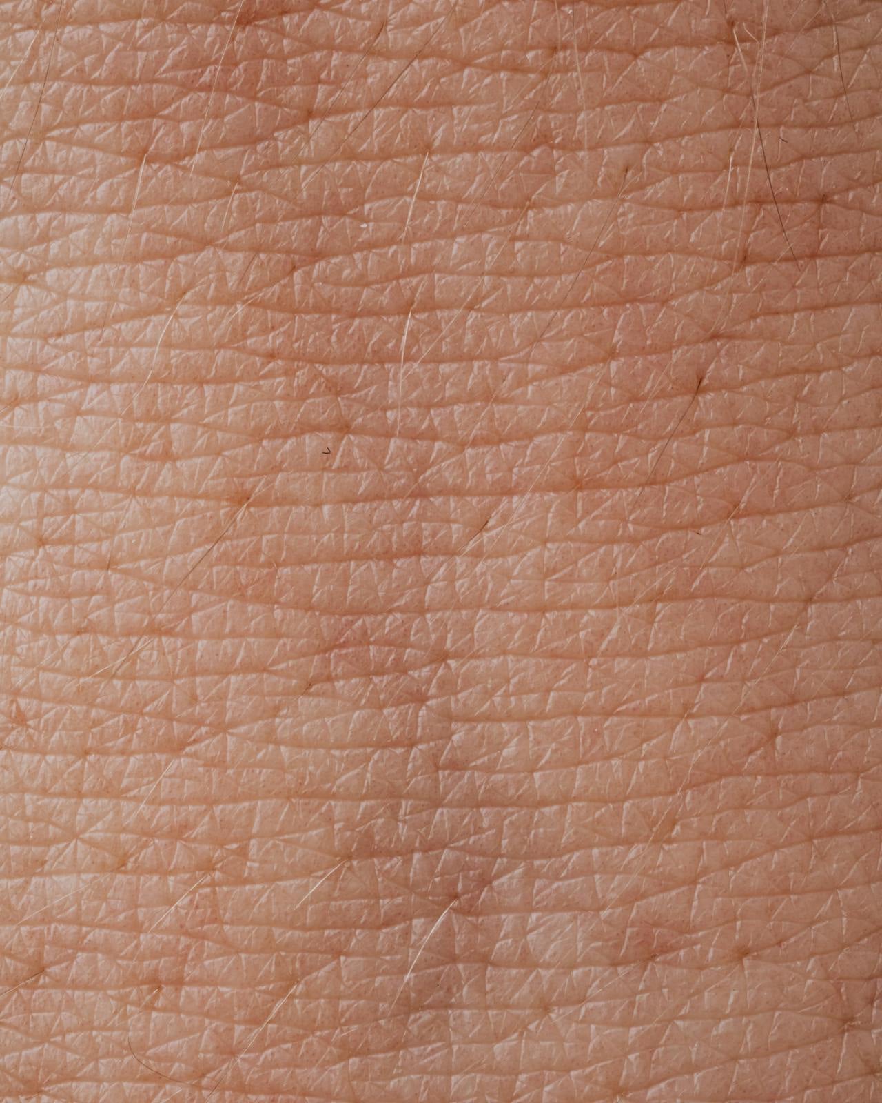 How to Identify Dehydrated vs Dry Skin