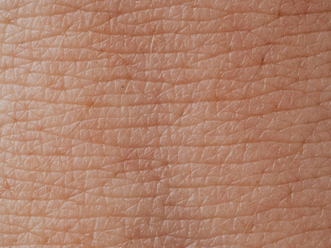 How to Identify Dehydrated vs Dry Skin